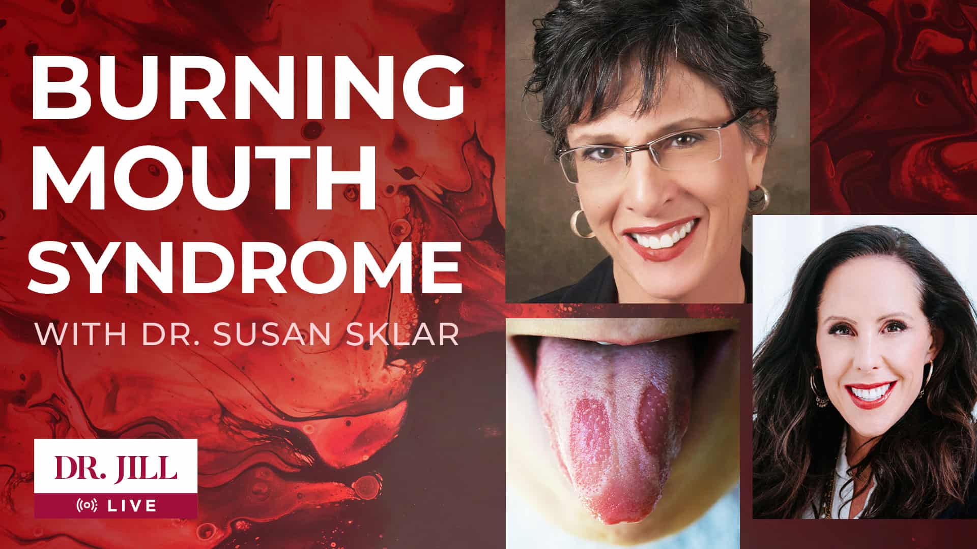 #47: Dr. Jill interviews Dr. Susan Sklar on Burning Mouth Syndrome